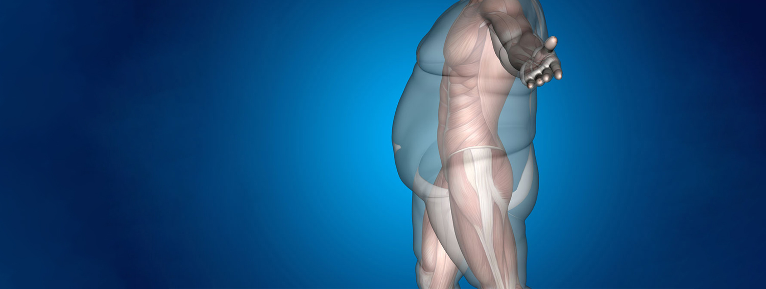 Gastrik Bypass